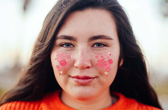 Best foundation for red sensitive skin top