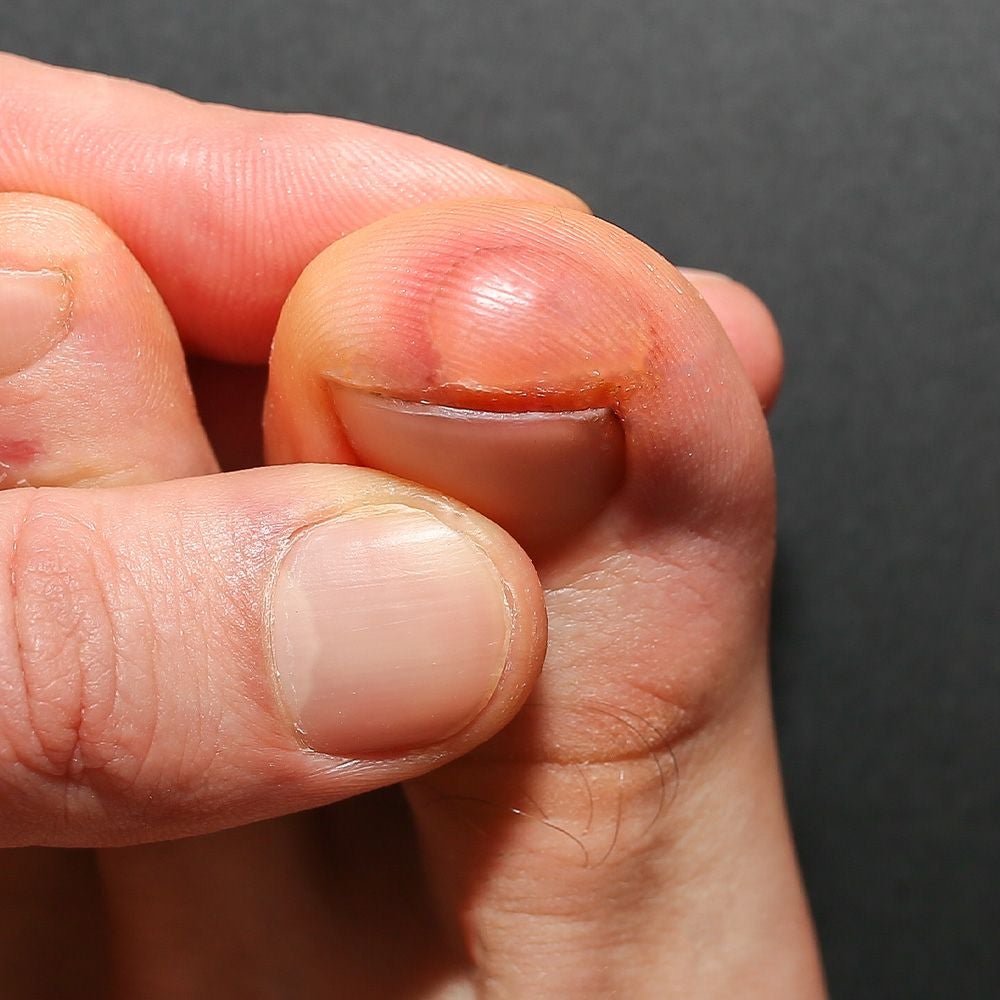 Blisters Boots