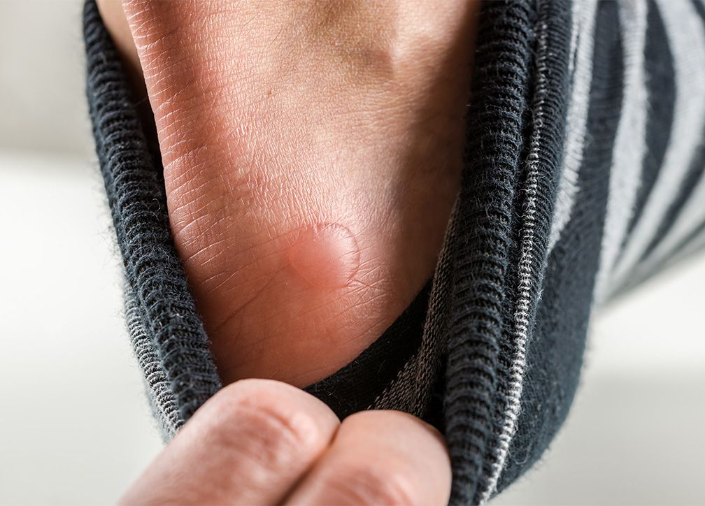 Blisters Boots
