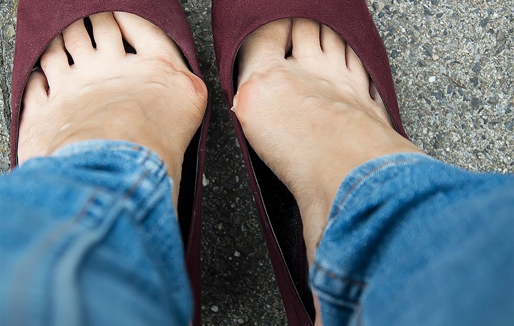 Shoes that sale help with bunions