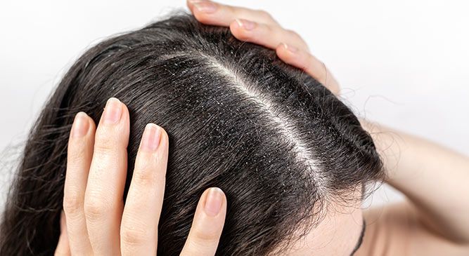 Dandruff Advice and Treatment Boots Health Hub